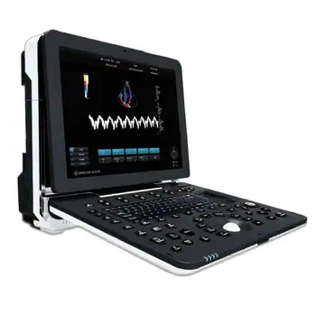 Доплер лаптоп ултразвукова машина с 15-инчов пълен изглед медицински HD дисплей на главния екран